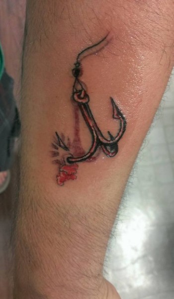anchor